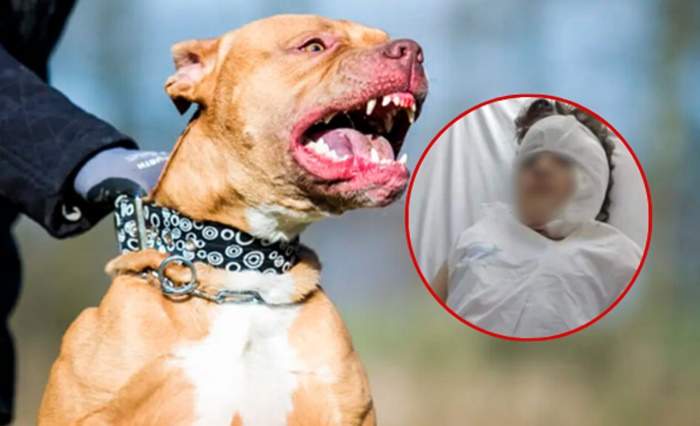 HORROR: UN PITBULL ATACÓ A UNA NIÑA DE 8 AÑOS Y LE DESFIGURÓ LA CARA